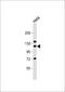 Staphylococcal Nuclease And Tudor Domain Containing 1 antibody, 58-058, ProSci, Western Blot image 