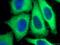 Chaperonin Containing TCP1 Subunit 3 antibody, 10571-1-AP, Proteintech Group, Immunofluorescence image 