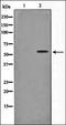 Nuclear Factor Kappa B Subunit 2 antibody, orb106473, Biorbyt, Western Blot image 