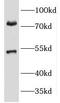 Potassium Voltage-Gated Channel Subfamily A Member 3 antibody, FNab04663, FineTest, Western Blot image 