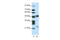 PHD Finger Protein 11 antibody, 28-204, ProSci, Western Blot image 