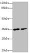 Ring Finger Protein 148 antibody, A60634-100, Epigentek, Western Blot image 