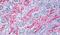 Frizzled Class Receptor 10 antibody, PA5-33551, Invitrogen Antibodies, Immunohistochemistry paraffin image 