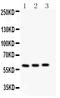 Cytochrome P450 Family 11 Subfamily A Member 1 antibody, PA1698-1, Boster Biological Technology, Western Blot image 