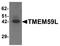 Transmembrane Protein 59 Like antibody, LS-B9549, Lifespan Biosciences, Western Blot image 
