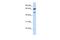 Gamma-Aminobutyric Acid Type A Receptor Gamma2 Subunit antibody, PA5-71457, Invitrogen Antibodies, Western Blot image 