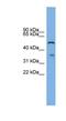 Beta-1,3-Glucuronyltransferase 3 antibody, NBP1-59853, Novus Biologicals, Western Blot image 