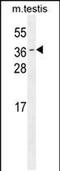 Outer Dense Fiber Of Sperm Tails 3 antibody, PA5-48279, Invitrogen Antibodies, Western Blot image 