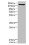 Lymphocyte Antigen 75 antibody, LS-C676008, Lifespan Biosciences, Western Blot image 