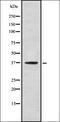 Olfactory Receptor Family 5 Subfamily T Member 1 antibody, orb336440, Biorbyt, Western Blot image 