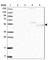 Regulator Of Microtubule Dynamics 2 antibody, HPA034705, Atlas Antibodies, Western Blot image 