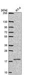 Ubiquitin Conjugating Enzyme E2 V1 antibody, PA5-65729, Invitrogen Antibodies, Western Blot image 