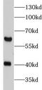 Matrix Metallopeptidase 16 antibody, FNab10494, FineTest, Western Blot image 