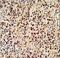 LCK Proto-Oncogene, Src Family Tyrosine Kinase antibody, LS-C165716, Lifespan Biosciences, Immunohistochemistry frozen image 