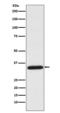 Uracil DNA Glycosylase antibody, M01672-2, Boster Biological Technology, Western Blot image 