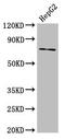 ATP Binding Cassette Subfamily G Member 5 antibody, LS-C672711, Lifespan Biosciences, Western Blot image 