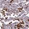 HIC ZBTB Transcriptional Repressor 1 antibody, PA5-60343, Invitrogen Antibodies, Immunohistochemistry frozen image 