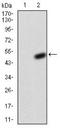 Potassium Voltage-Gated Channel Subfamily D Member 2 antibody, NBP2-52497, Novus Biologicals, Western Blot image 