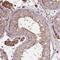 MAGE Family Member B5 antibody, NBP2-30617, Novus Biologicals, Immunohistochemistry paraffin image 