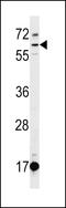 DEP Domain Containing 1B antibody, LS-C167365, Lifespan Biosciences, Western Blot image 