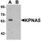 Karyopherin Subunit Alpha 5 antibody, LS-B9592, Lifespan Biosciences, Western Blot image 