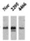 Calcium/Calmodulin Dependent Protein Kinase II Alpha antibody, GTX41977, GeneTex, Western Blot image 
