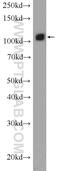 Ubiquitin Specific Peptidase 15 antibody, 14354-1-AP, Proteintech Group, Western Blot image 