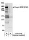 BRCA1 DNA Repair Associated antibody, NB100-226, Novus Biologicals, Western Blot image 