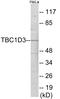 TBC1 Domain Family Member 3 antibody, EKC1870, Boster Biological Technology, Western Blot image 