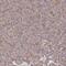 Katanin Regulatory Subunit B1 antibody, PA5-59462, Invitrogen Antibodies, Immunohistochemistry paraffin image 