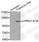 Protein Kinase D1 antibody, AP0151, ABclonal Technology, Western Blot image 