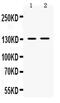 Transient Receptor Potential Cation Channel Subfamily M Member 5 antibody, PA5-80191, Invitrogen Antibodies, Western Blot image 