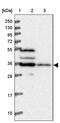Transmembrane Protein 176B antibody, PA5-61537, Invitrogen Antibodies, Western Blot image 