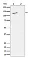 Minichromosome Maintenance Complex Component 2 antibody, P00374, Boster Biological Technology, Western Blot image 