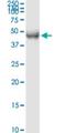 Transcription Factor Dp-2 antibody, H00007029-M01, Novus Biologicals, Western Blot image 