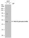 Protein Kinase CAMP-Dependent Type II Regulatory Subunit Alpha antibody, PA5-78122, Invitrogen Antibodies, Western Blot image 