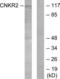 Connector Enhancer Of Kinase Suppressor Of Ras 2 antibody, LS-C119177, Lifespan Biosciences, Western Blot image 