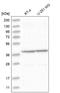 Bardet-Biedl Syndrome 9 antibody, NBP1-88927, Novus Biologicals, Western Blot image 