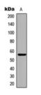 Checkpoint Kinase 1 antibody, orb393242, Biorbyt, Western Blot image 