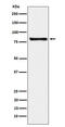 Microtubule Affinity Regulating Kinase 3 antibody, M05355-1, Boster Biological Technology, Western Blot image 