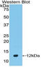 Defensin Beta 4B antibody, LS-C293661, Lifespan Biosciences, Western Blot image 