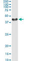 Small Glutamine Rich Tetratricopeptide Repeat Containing Alpha antibody, LS-C198184, Lifespan Biosciences, Immunoprecipitation image 