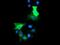 Histone Deacetylase 6 antibody, NBP2-03269, Novus Biologicals, Immunocytochemistry image 