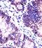 KH RNA Binding Domain Containing, Signal Transduction Associated 1 antibody, M01717, Boster Biological Technology, Immunohistochemistry paraffin image 