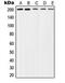 TSC Complex Subunit 2 antibody, MBS8219954, MyBioSource, Western Blot image 