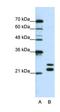 Cold Shock Domain Containing C2 antibody, orb324897, Biorbyt, Western Blot image 