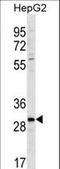 Palmitoyltransferase ZDHHC3 antibody, LS-C160753, Lifespan Biosciences, Western Blot image 