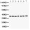 Annexin A3 antibody, PB9420, Boster Biological Technology, Western Blot image 