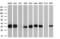 NADH-cytochrome b5 reductase 3 antibody, GTX84645, GeneTex, Western Blot image 