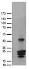 Choriogonadotropin subunit beta antibody, TA890044, Origene, Western Blot image 